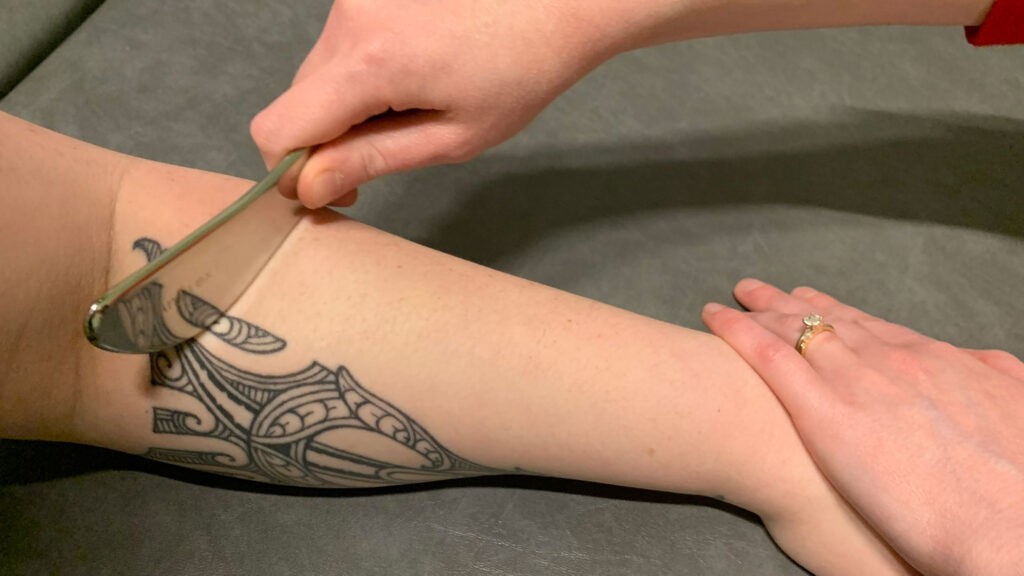 IASTM on Arm
